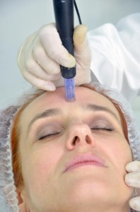 dermapen