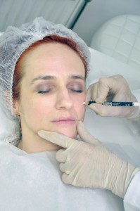 lice fileri nehirurški facelifting